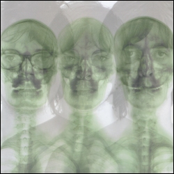 Supergrass/The X-Ray Album